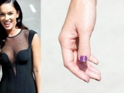 Brachydaktylia czyli krótkopalczastość, SPRAWDŹ czy ją masz! krótkopalczastość