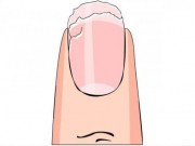 Sposoby na łamliwe paznokcie – SZYBKI PORADNIK! lamliwe-paznokcie