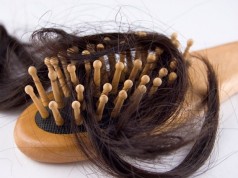 Nadmierne wypadanie włosów? zrób TE badania!