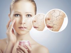 Sucha skóra twarzy – sposoby jak sobie z nią radzić! sucha-skora-twarzy