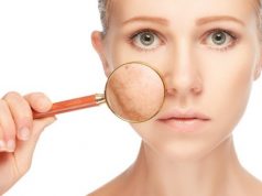 Cera naczynkowa – pielęgnacja czy-to-cera-naczynkowa