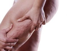 Zioła na cellulit, czyli sposoby na walkę z pomarańczową skórką ziola-na-cellulit