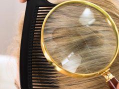 Jak zwalczyć łupież tłusty? objawy – leczenie i przyczyny łupieżu łupież-łojotokowy