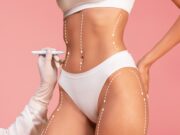 Pokonaj cellulit. Jak się pozbyć skórki pomarańczowej? spectrum-krakow